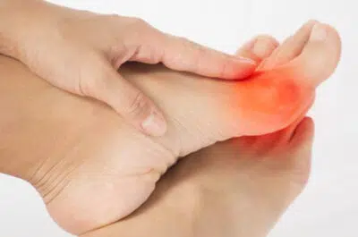 Pied avec gros orteil douloureux en rouge – fracture de l'hallux | IK Kiné et Balnéo Paris