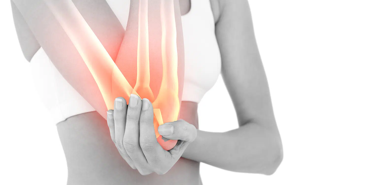 Image montrant les bras d une femme tenant son coude - fracture olecrane | IK Paris